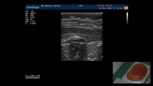 Ультразвуковая анатомия молочной железы: практическое занятие на фантоме