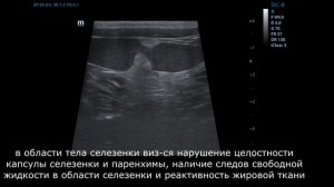 УЗ-патологии селезенки