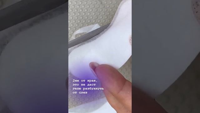 Слизливые, светочувствительные глаза