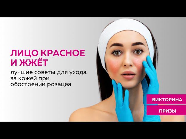 ЛИЦО КРАСНОЕ И ЖЖЁТ: лучшие советы для ухода за кожей при обострении розацеа