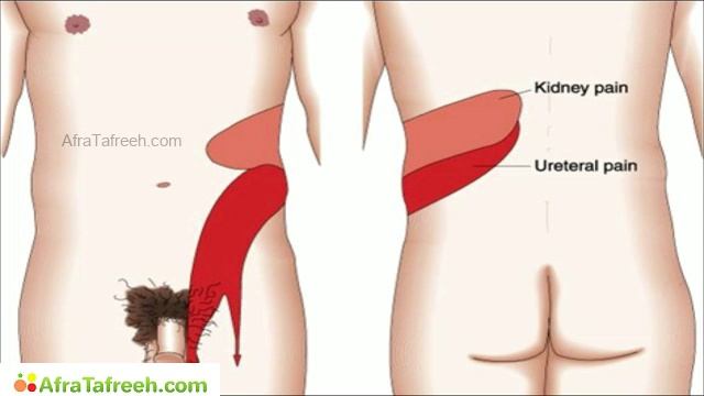 MedQuest’s Get Physical 2023 — Мочеполовой тракт 1/1 РАЗДЕЛ — (для USMLE Step 1, COMLEX)