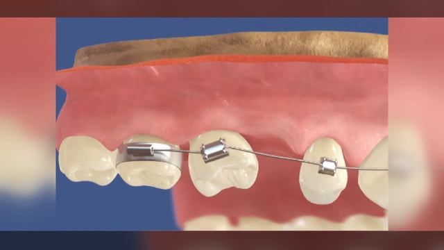 Ортодонтическая стоматология в Воронеже _ «Дентика».mp4