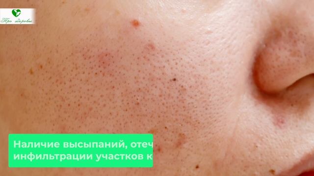 Супер ПРОДУКТ для кожи и волос! (впечатляет) смотреть онлайн