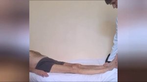 Радикулопатия