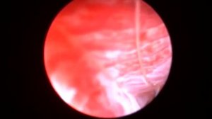 Нитка в носу у кошки, удаление санацией под видеоконтролем