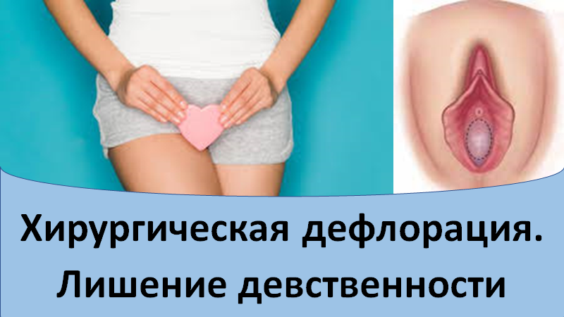 Хирургическая дефлорация. Лишение девственности