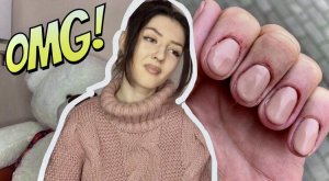 ОСТАЛАСЬ БЕЗ НОГТЕЙ ПОСЛЕ УЖАСНОГО НАРАЩИВАНИЯ В САЛОНЕ