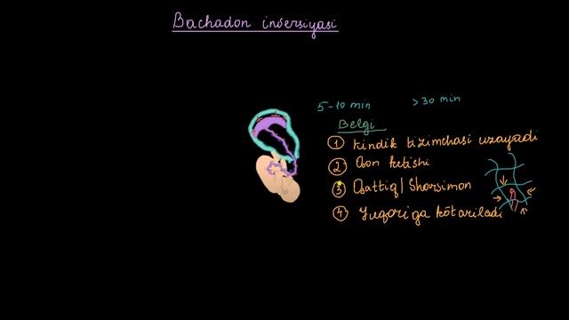 Bachadon inversiyasi | Homiladorlik va homiladorlik asoratlari | Tibbiyot смотреть онлайн