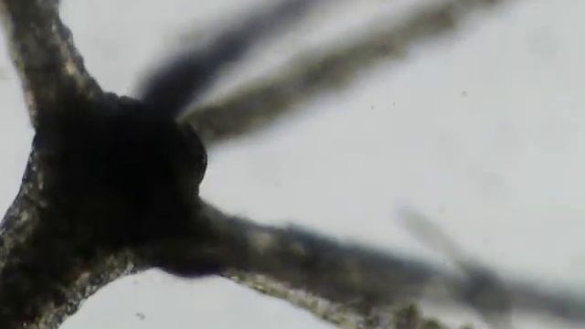 Гидра и Kerona pediculus ( инфузория) смотреть онлайн