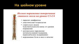 Синдромы поражения спинного мозга
