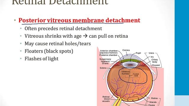 Неврология USMLE - 5. Глаз - 3.Сетчатка