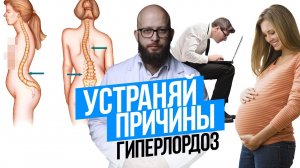 Гиперлордоз. Выпячивание живота. Причины и понимание проблем с телом.