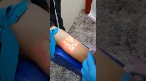 Перед тем как сделать укол, нужно найти вену