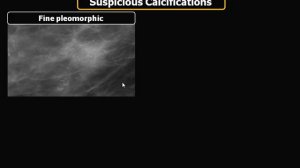 Mammography BIRADS lexicon   Prof Dr  Rasha Kamal In Arabic