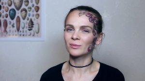 МОЯ ИСТОРИЯ УДАЛЕНИЯ РОДИНОК ❖  ГИСТОЛОГИЯ ❖ СТРАХ МЕЛАНОМЫ