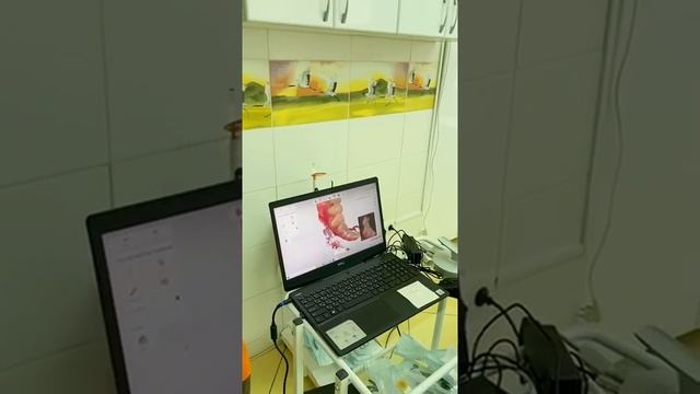Внутриротовой сканер.