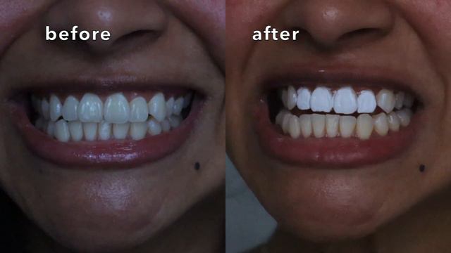 I tested VIRAL TOOTH WHITENING PAINT & THIS HAPPENED! | does tooth polish work? 😳 смотреть онлайн