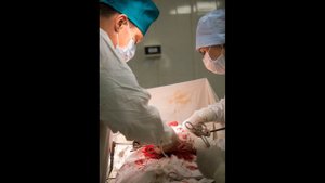 Резекция желудка