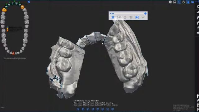 DOF Swing - дентальный 3D сканер, обработка модели в программе | DOF Inc. (Ю. Корея) смотреть онлайн