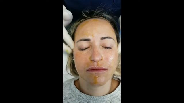 Face Protocol BioRePeelCl3 FND смотреть онлайн