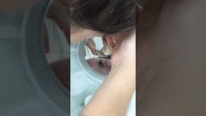 Как правильно снять ночную линзу