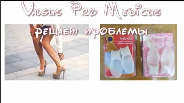 Вальгус медикус смотреть онлайн