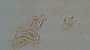 Моча человека под микроскопом. Часть 2.