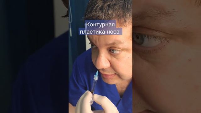 Как убрать горбинку носа?