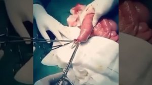 Достали килограмм червяков из кишок!! Шок контент!!