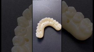 Конструкция из диоксида циркония на верхнюю челюсть с искусственной десной.