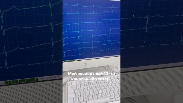 Суточный мониторинг ритма сердца. Исследование сердца. Сардар Алиханов смотреть онлайн