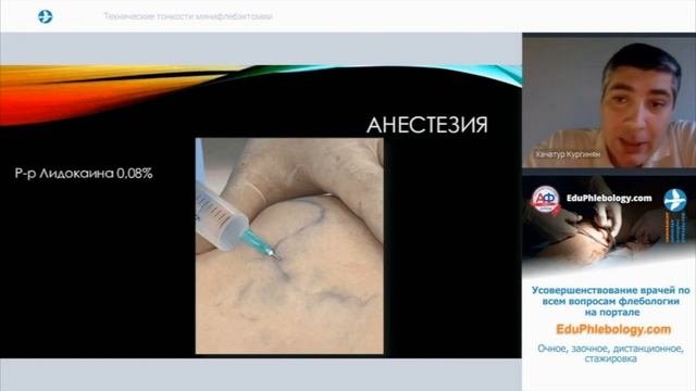 Кургинян Х. М. Технические аспекты минифлебэктомии.