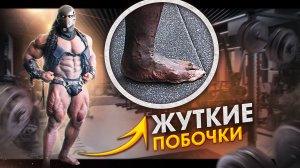 ПОСЛЕДСТВИЯ СТЕРОИДОВ И СИНТОЛА! НОВЫЕ ЖЕРТВЫ В БОДИБИЛДИНГЕ