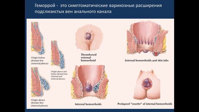 Сосудистые анастомозы. Кровообращение плода 23.04.21 - 14:15 смотреть онлайн