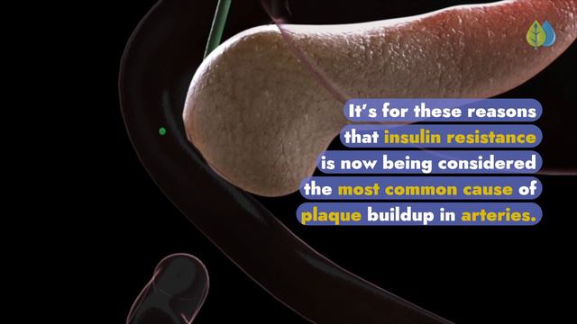 #1 Hidden Cause of Clogged Arteries смотреть онлайн