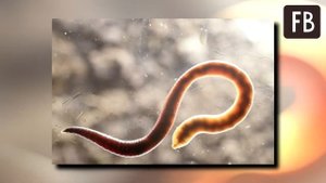 к чему чешется попа? Опасно это или нет? Приметы