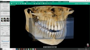 Что такое Smart Focus на Green X 12