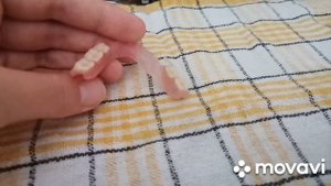 Отзыв на съёмный протез