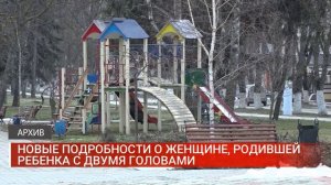 Новые подробности о женщине, родившей ребенка с двумя головами