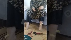 асептический некроз головки бедренной кости.