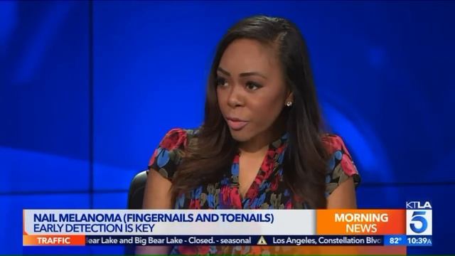 Nurse Alice on KTLA: What is nail melanoma?