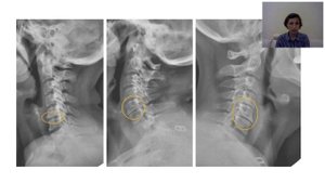 Введение в рентгенанатомию