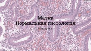 Матка. Нормальная гистология