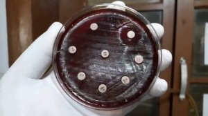 Klebsiella/Staphylococcus/ Beta-haemolytic Streptococci/ Enterococcus/ Serratia/ Micrococcus