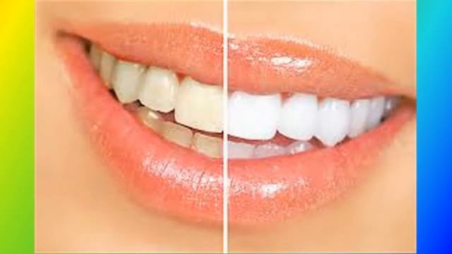 Mười Triệu Chứng Nha Khoa Phổ Biến Nhất смотреть онлайн