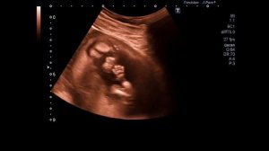 СРОК ПОЯВЛЕНИЯ ПЕРВОГО ШЕВЕЛЕНИЯ ВО ВРЕМЯ БЕРЕМЕННОСТИ | На каком сроке начинает шевелиться ребенок