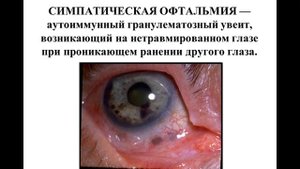 Лекция 09-1.
Леч_Пед.
Аллергия. V тип.