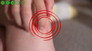 Укусы насекомых! Эти 5 укусов насекомых, нужно знать. | Я знаю