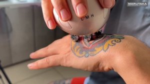 БРУКСИЗМ ЛЕЧЕНИЕ | Как избавиться раз и навсегда? #бруксизм