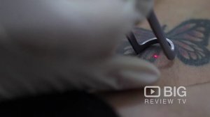 The Laser Diva, Hair and Beauty Salon in Sydney for Laser Hair Removal or for Tattoo Removal